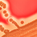 Superbakterie stafylokok