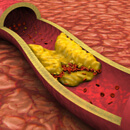 Cholesterol – ziskuchtivý podvod kolem životně nezbytné látky